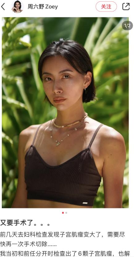 【捕鱼王】博主周六野自曝患病,因前男友长六颗子宫肌瘤!呼吁女生爱惜自己【EV扑克官网】