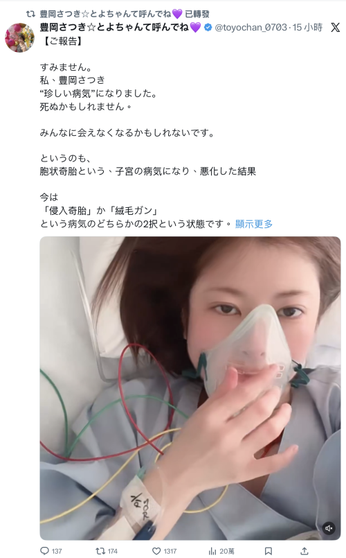 【捕鱼王】豊岡さつき(丰冈沙月)自爆罹患罕见疾病、可能致命！【EV扑克下载】